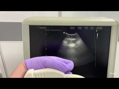 Samsung Medison SonoAce X8 Ultrasound System & 2 Probe