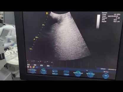 GE Vivid S5 Ultrasound System & 3 Probe