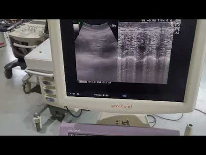 Used Aloka ProSound Alpha 6 Ultrasound System for Sale