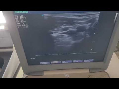 For Sale Used Sonoscape S8 Portable Ultrasound & 3Probes