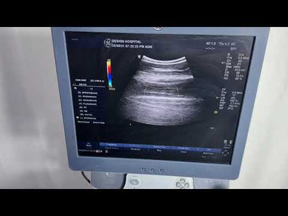 Used GE Healthcare LOGIQ P6 Ultrasound System & 2Probes for Sale