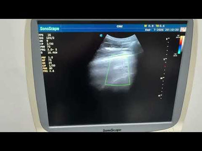Used SonoScape S20 Ultrasound System for Sale
