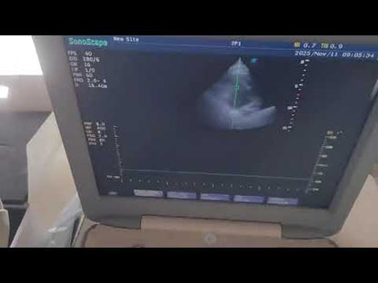 For Sale Used Sonoscape S8 Portable Ultrasound & 3Probes