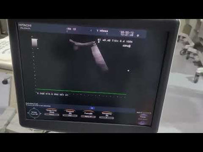 Used Hitachi Aloka F37 Ultrasound System for Sale