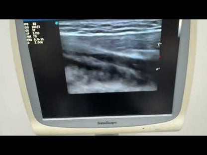 Used SonoScape S20 Ultrasound System for Sale