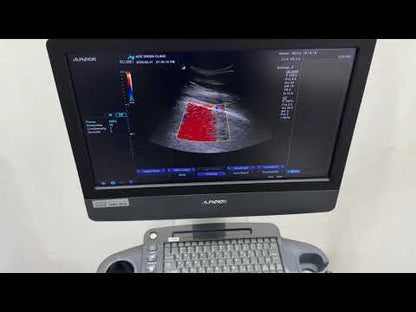 Used Alpinion E-CUBE 7 Ultrasound System & 2Probes for Sale